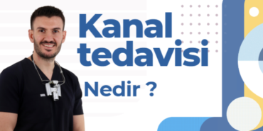 kanal tedavisi - Kopya (2)