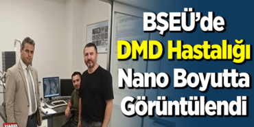 DMD hastalığı nano boyutta görüntülendi