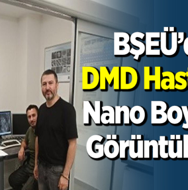 DMD hastalığı nano boyutta görüntülendi