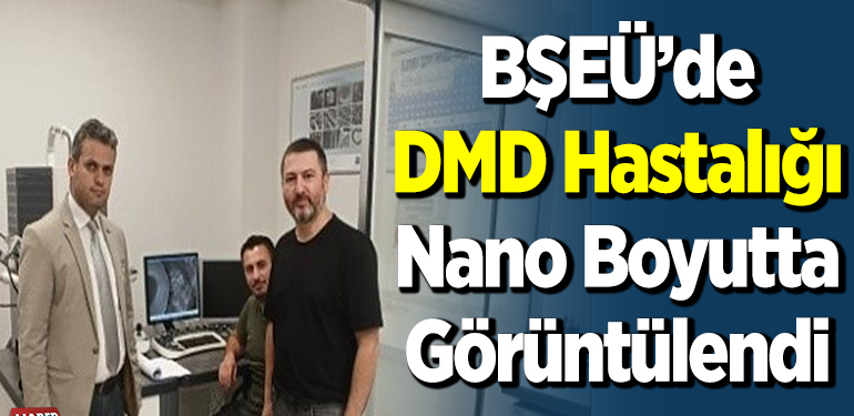 DMD hastalığı nano boyutta görüntülendi