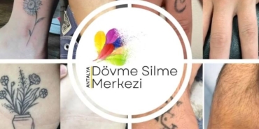 Antalya Dövme Silme Merkezi