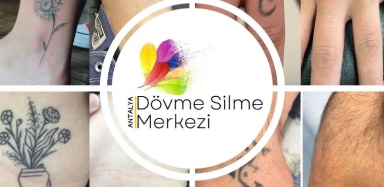 Antalya’da Dövme Silme Teknolojisi ile Cildinizi Temizleyin