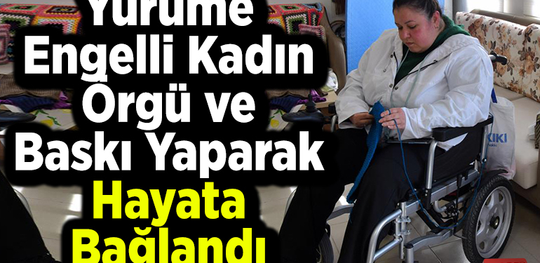 Yürüme engelli kadın örgü ve baskı yaparak hayata bağlandı