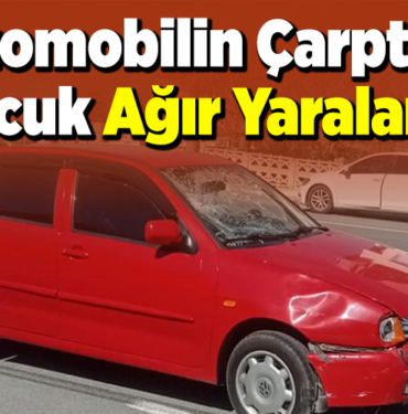 Otomobilin çarptığı çocuk ağır yaralandı