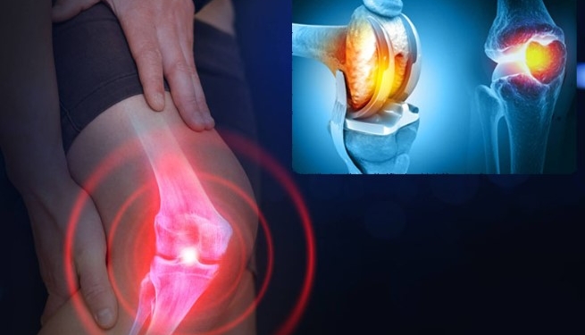 Diz Protezi Sonrası Hayatınızı Değiştirin