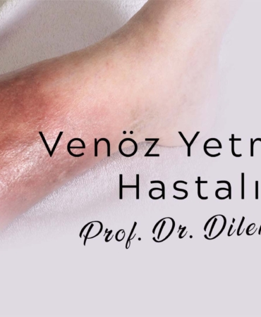 dosya-1725013184-venoz-yetmezlik-hastaligi