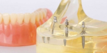 Konya implant, Konya implant fiyatları
