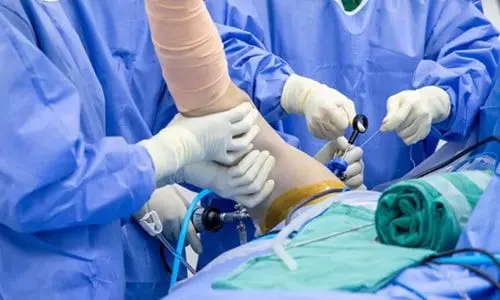 Ön Çapraz Bağ (ÖÇB) Kopması Nedir, Kimlerde Görülür?