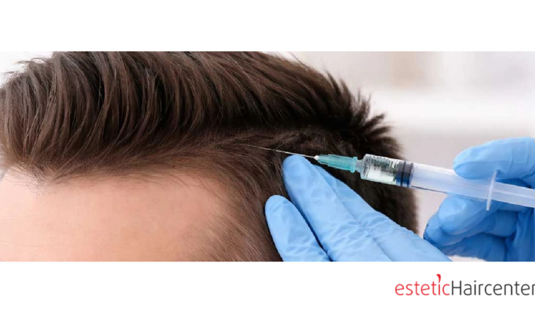 Bursa Saç Tedavisi ile Sağlıklı Saçlara Kavuşun