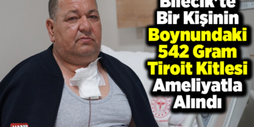 Bilecik'te bir kişinin boynundaki 542 gram tiroit kitlesi ameliyatla alındı