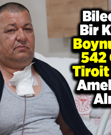 Bilecik'te bir kişinin boynundaki 542 gram tiroit kitlesi ameliyatla alındı
