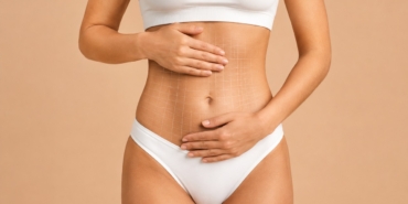 liposuction-1