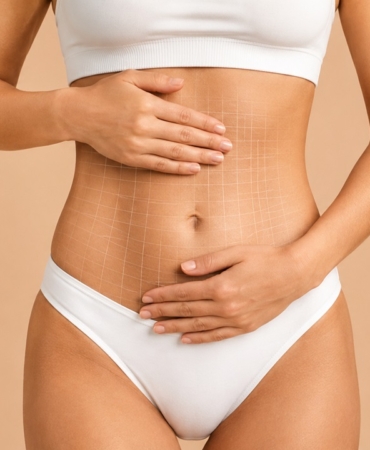 liposuction-1